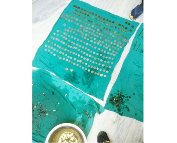 Хирурги вытащили из мужчины 7 килограммов металлических изделий