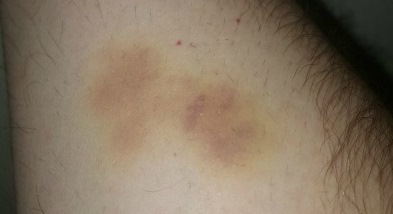 Американец рассказал, что рептилоиды уже трижды похищали его за последние 2 года