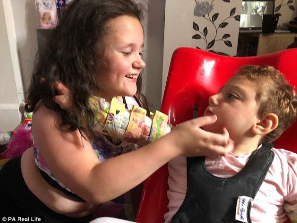 Как живет девочка, которой после рождения из-за редкой аномалии удалили большую часть мозга