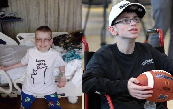 Родившийся с кучей патологий и почти всеми органами наружу мальчик отпраздновал свое 17-летие