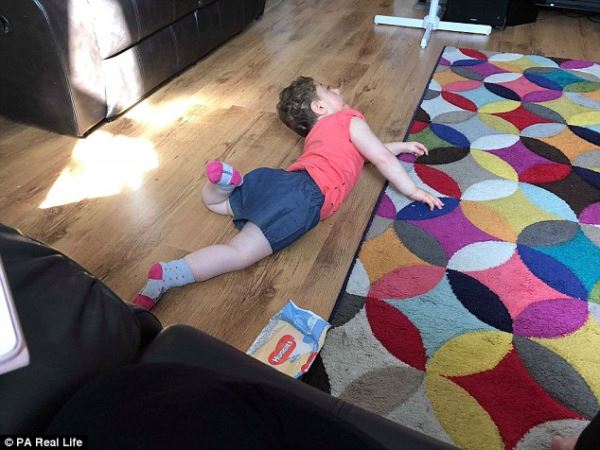 Как живет девочка, которой после рождения из-за редкой аномалии удалили большую часть мозга