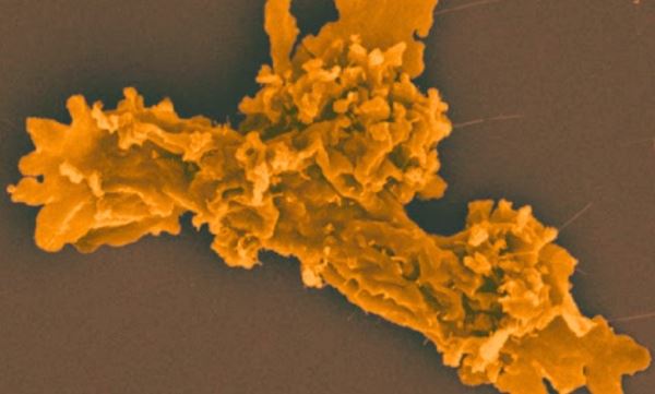 Жизнь в кипятке: открыта амеба, меняющая представления о пределах выживания