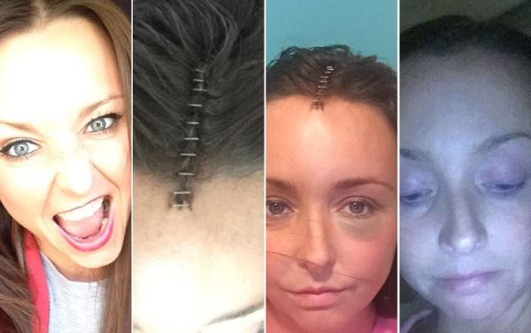 Случайная автомобильная авария странным образом спасла женщине жизнь