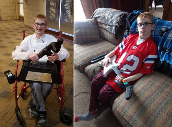 Родившийся с кучей патологий и почти всеми органами наружу мальчик отпраздновал свое 17-летие