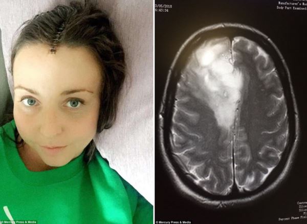 Случайная автомобильная авария странным образом спасла женщине жизнь