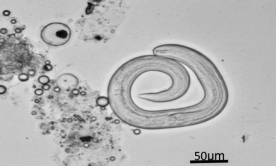 Китайская семья обожала есть сырых многоножек и заразилась от них опасными паразитами