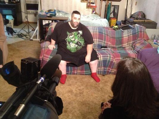 Мужчина 9 лет прожил с огромной мошонкой, весившей 36 кг