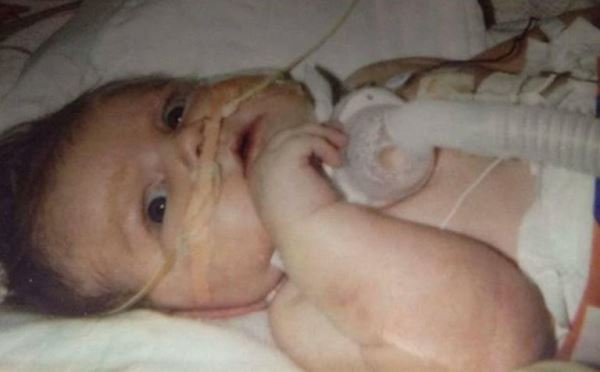 Родившийся с кучей патологий и почти всеми органами наружу мальчик отпраздновал свое 17-летие